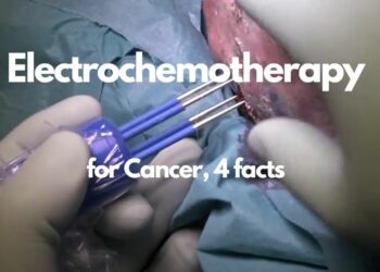 electrochemotherapy